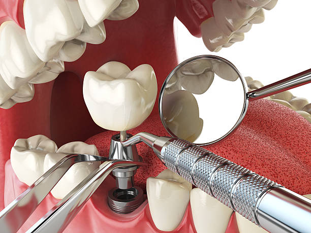 Best Cracked Tooth Emergency Dentist  in Richmond Heights, FL